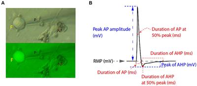 rdHSV-CA8 non-opioid analgesic gene therapy decreases somatosensory neuronal excitability by activating Kv7 voltage-gated potassium channels